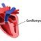 Cardiomyopathy: Symptoms, diagnosis and treatment